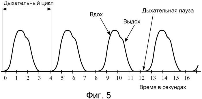 Способ и устройство для использования времяпролетной информации для обнаружения и введения поправки на движение в сканограммах (патент 2554378)