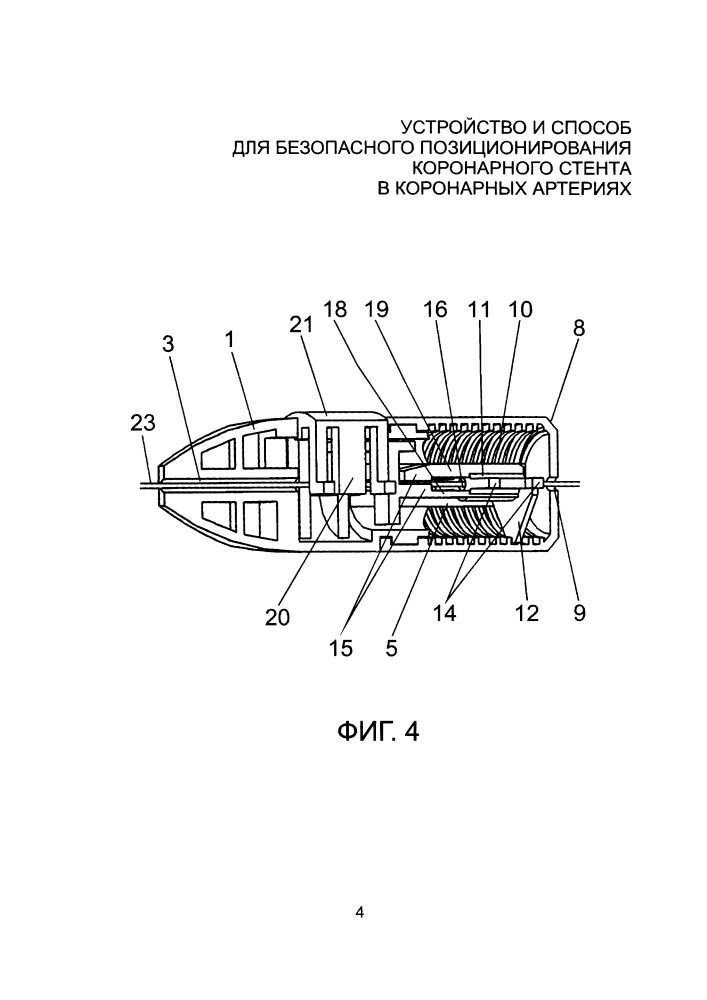 Устройство и способ для безопасного позиционирования коронарного стента в коронарных артериях (патент 2652732)