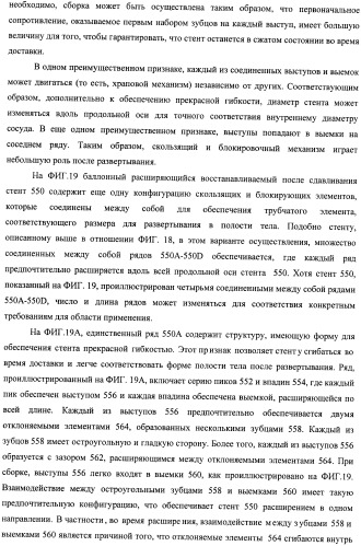 Баллонный расширяющийся стент, способный на восстановление расширения (патент 2388433)