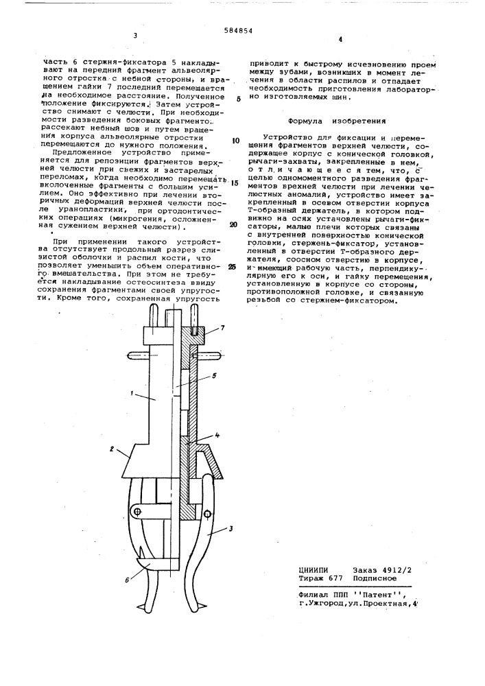 Устройство для фиксации и перемещения фрагментов верхней челюсти (патент 584854)