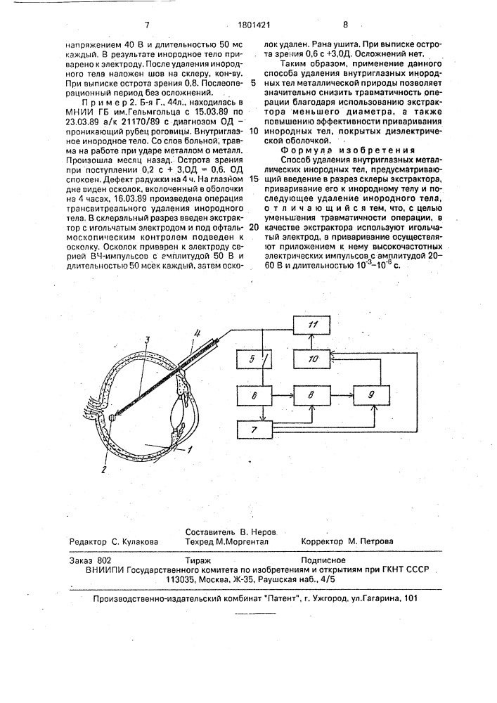 Способ удаления внутриглазных металлических инородных тел (патент 1801421)