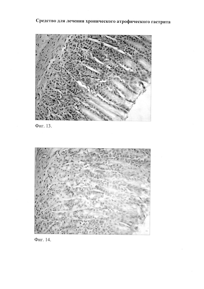 Средство для лечения хронического атрофического гастрита (патент 2623866)