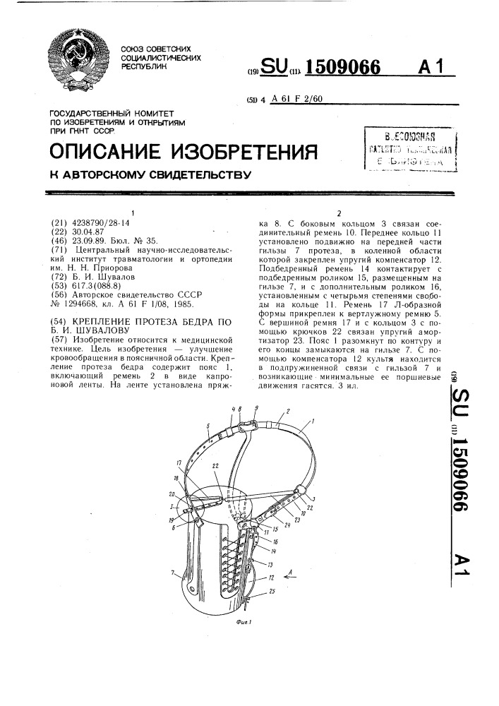 Крепление протеза бедра по б.и.шувалову (патент 1509066)