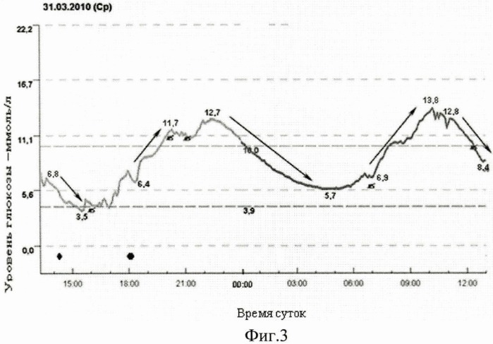 Способ прогнозирования жизнеугрожающих желудочковых аритмий у больных сахарным диабетом 2 типа, страдающих хронической сердечной недостаточностью (патент 2477477)