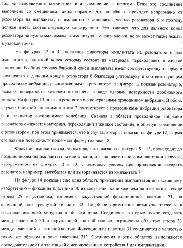 Имплантаты для создания соединений с тканями, в частности со скелетом, а также устройство и способ имплантации (патент 2314768)
