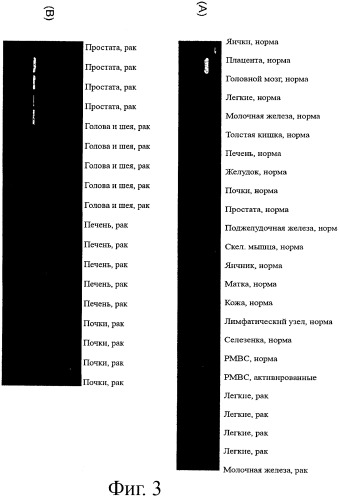 Идентификация опухолевых антигенов для диагностики и терапии (патент 2485974)