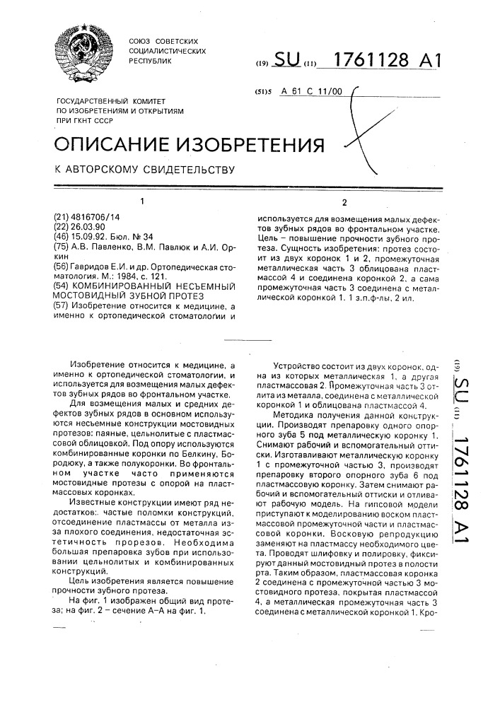 Комбинированный несъемный мостовидный зубной протез (патент 1761128)