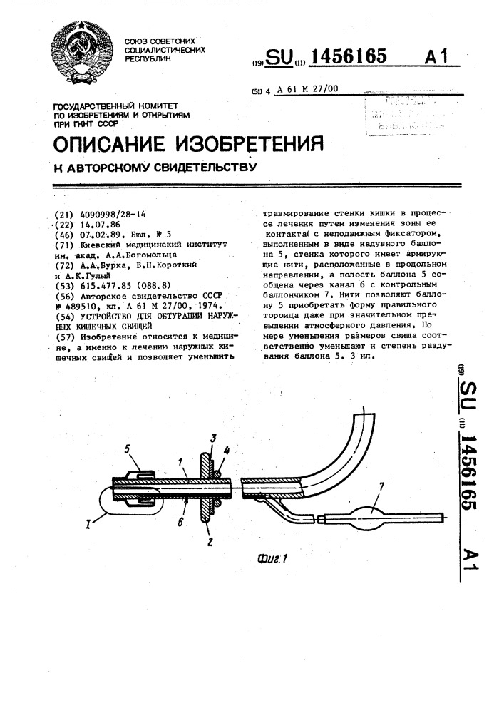 Устройство для обтурации наружных кишечных свищей (патент 1456165)