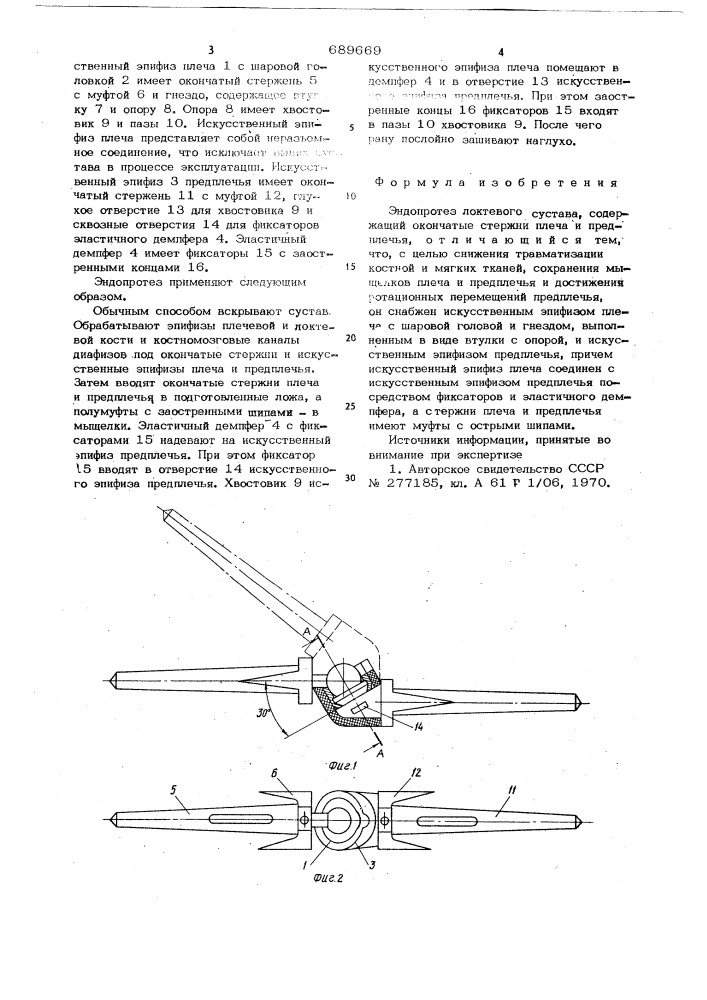 Эндопротез локтевого сустава системы к.м.сиваша (патент 689669)