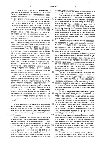 Способ исследования прямой кишки (патент 2004195)