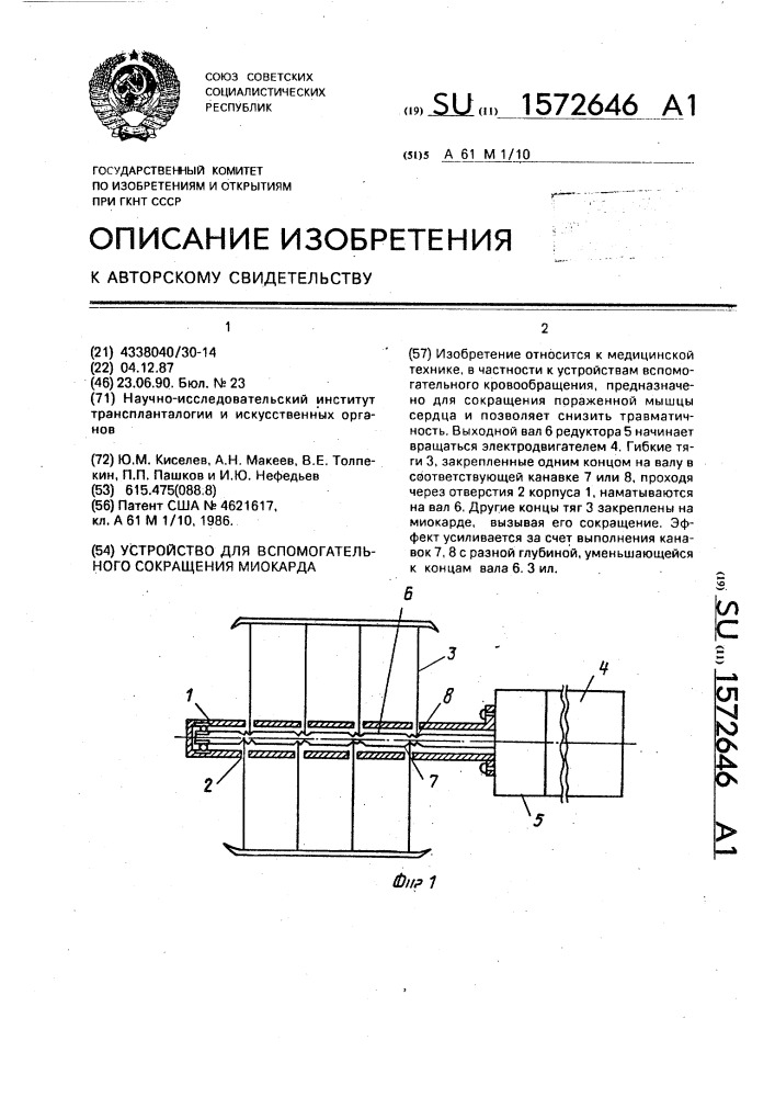 Устройство для вспомогательного сокращения миокарда (патент 1572646)