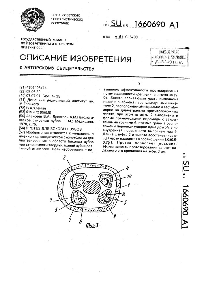 Протез для боковых зубов (патент 1660690)