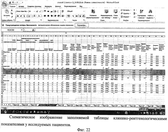 Способ диагностики стенозирующих процессов позвоночного канала и дурального мешка на поясничном уровне (патент 2483675)