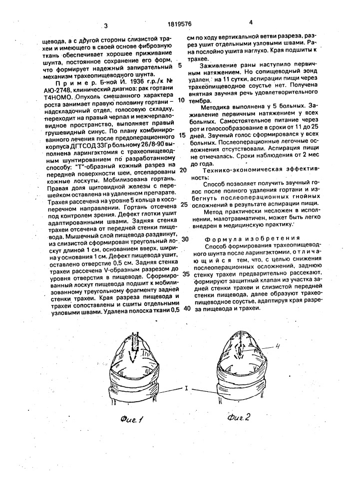 Способ формирования трахеопищеводного шунта после ларингэктомии (патент 1819576)
