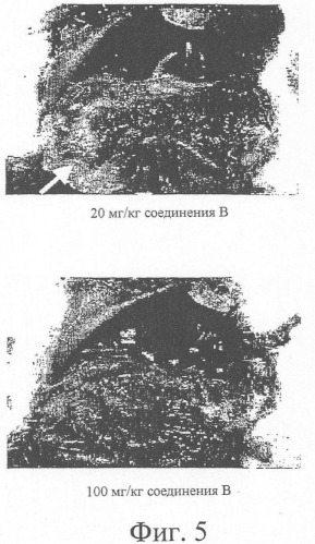 Регулирование содержания жира (патент 2346688)