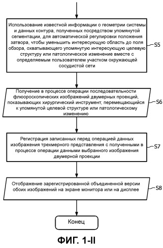 Система и способ получения ангиографических изображений с автоматической регулировкой затвора для получения уменьшенного поля обзора, охватывающего сегментированную целевую структуру или патологическое изменение для уменьшения дозы рентгеновского излучения при минимально инвазивных вмешательствах с рентгенографическим контролем (патент 2521692)