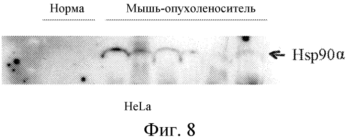 Новый опухолевый биомаркер (патент 2567005)