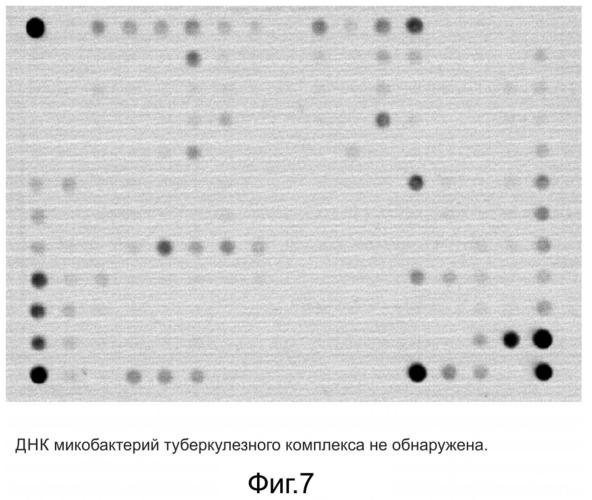 Способ обнаружения днк возбудителя туберкулеза с одновременным установлением его генотипа и определением генетических детерминант множественной и широкой лекарственной устойчивости, олигонуклеотидный микрочип, набор праймеров и набор олигонуклеотидных зондов, используемые в способе (патент 2562866)