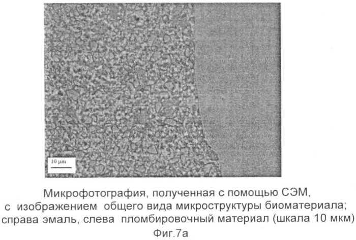 Композиция стоматологического пломбировочного материала или материала имплантата и порошкообразный материал, жидкость для гидратации, материал имплантата и способ достижения связывания (патент 2332201)