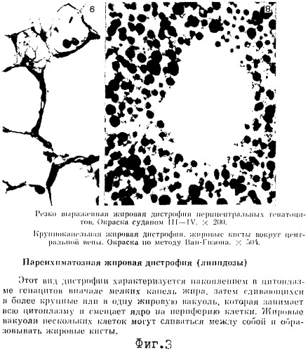 Способ экспресс-диагностики жирового гепатоза (патент 2305840)