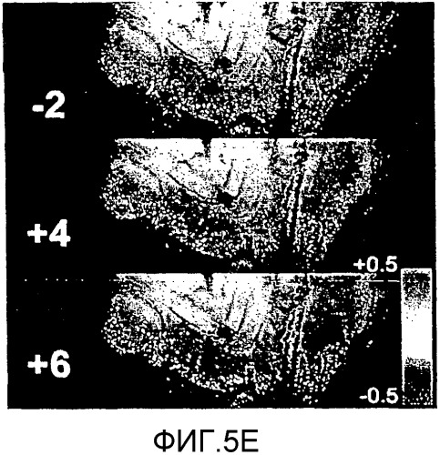 Сенсибилизированный оперативный bold-mri способ получения изображения (патент 2343829)