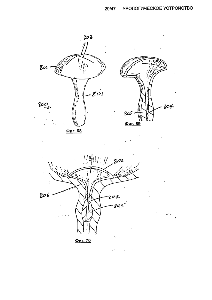 Урологическое устройство (патент 2600865)