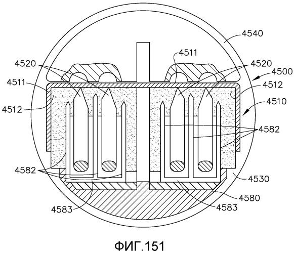 Имплантируемая кассета с крепежными элементами, имеющая неравномерную конструкцию (патент 2574370)