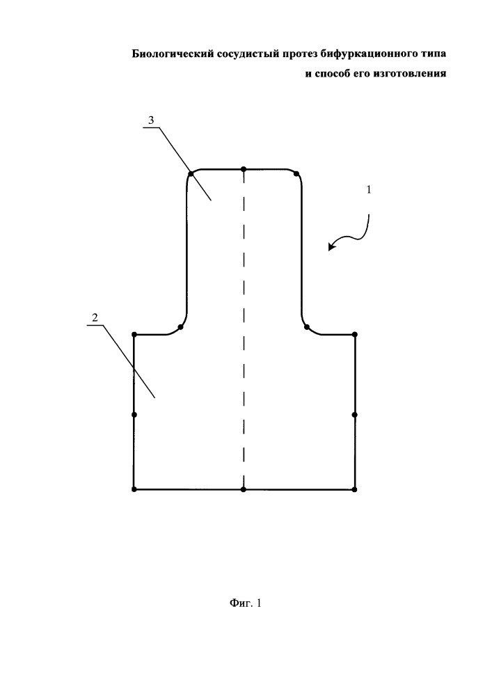 Биологический сосудистый протез бифуркационного типа и способ его изготовления (патент 2652870)