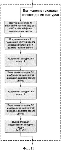 Способ автоматического определения размеров и положения сердца пациента по флюорографическим снимкам (патент 2372844)