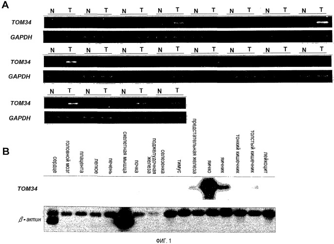 Связанный с раком толстого кишечника ген том34 (патент 2526196)