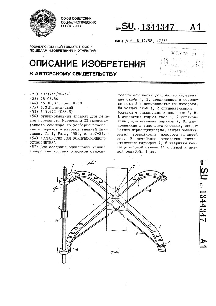 Устройство для компрессионного остеосинтеза (патент 1344347)