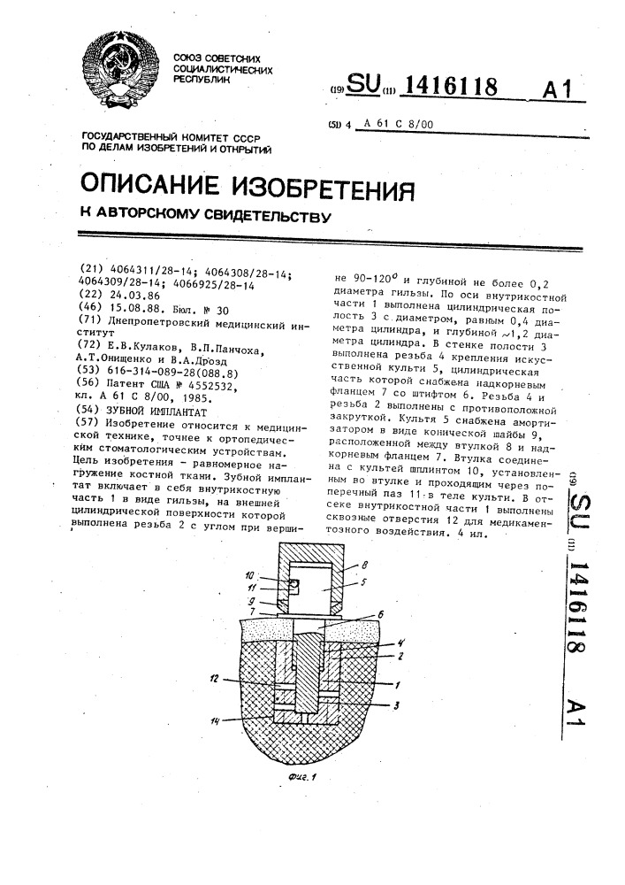 Зубной имплантат (патент 1416118)