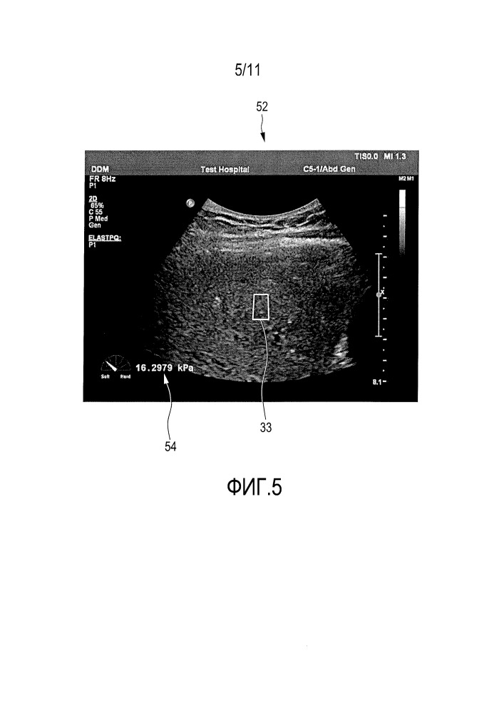 Система и способ эластографических измерений (патент 2667617)
