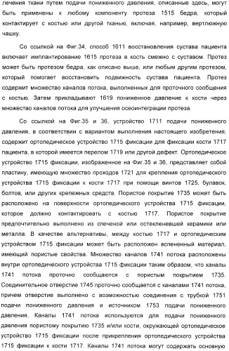 Устройство для лечения путем подкожной подачи пониженного давления с использованием разделения с помощью воздушного баллона (патент 2401652)