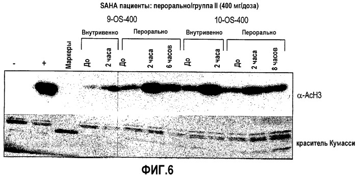 Способы лечения рака с использованием ингибиторов hdac (патент 2356547)