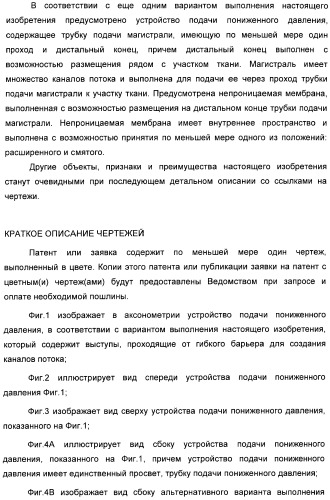 Устройство для лечения путем подкожной подачи пониженного давления с использованием разделения с помощью воздушного баллона (патент 2401652)