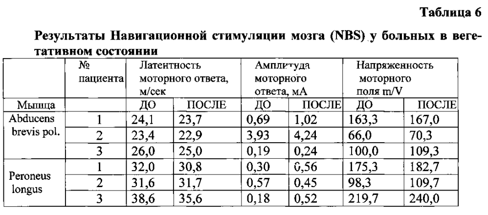 Способ диагностики нарушения сознания (патент 2596049)