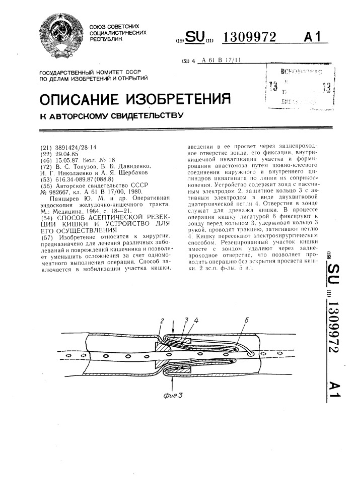 Способ асептической резекции кишки и устройство для его осуществления (патент 1309972)