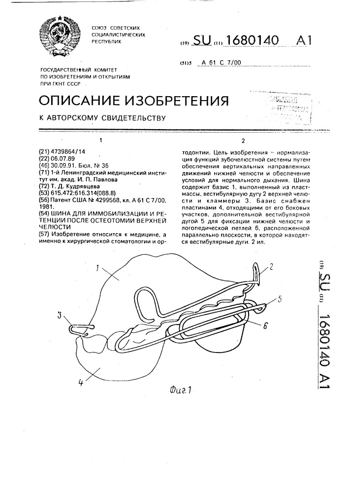 Шина для иммобилизации и ретенции после остеотомии верхней челюсти (патент 1680140)