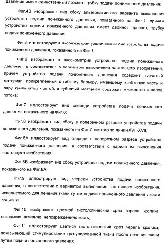 Способ лечения путем подкожной подачи пониженного давления с использованием разделения с помощью воздушного баллона (патент 2405588)