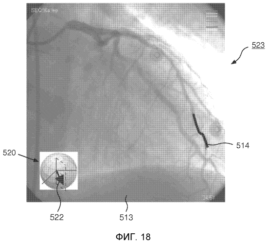 Навигация интервенционного устройства (патент 2569011)