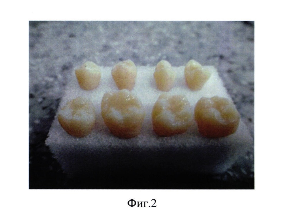 Способ контроля технологии моделирования микрорельефа окклюзионной поверхности зуба (патент 2606275)