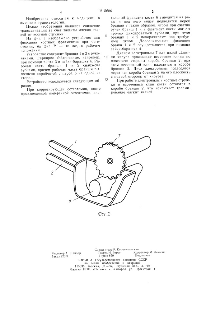 Устройство для фиксации костных фрагментов при остеотомии (патент 1215686)