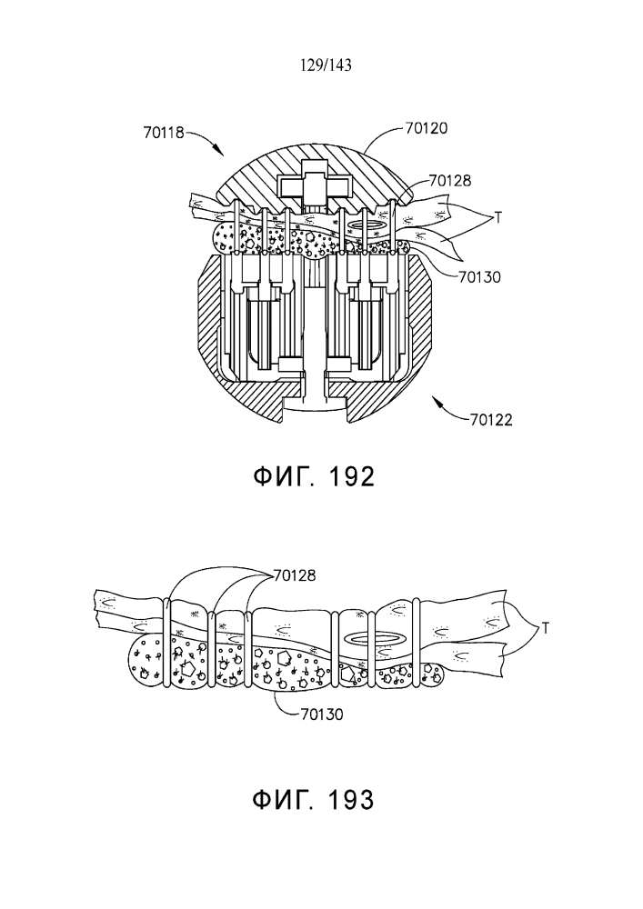 Компенсатор толщины ткани, содержащий контролируемое высвобождение и расширение (патент 2637167)