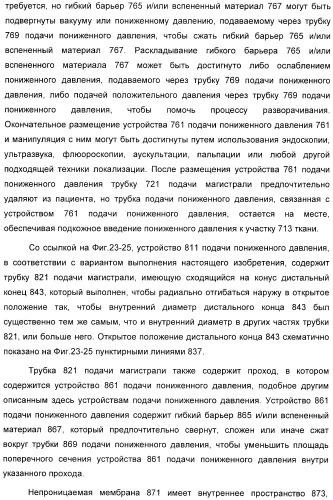 Устройство для лечения путем подкожной подачи пониженного давления с использованием разделения с помощью воздушного баллона (патент 2401652)