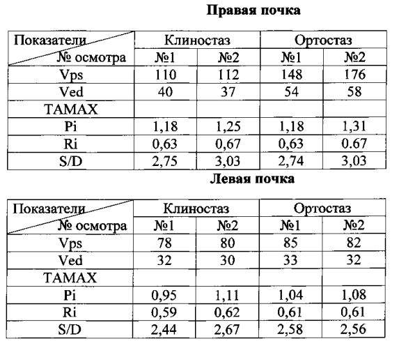 Способ ультразвуковой допплерографии при нефроптозе (патент 2571892)