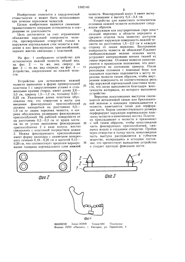 Устройство для остеосинтеза нижней челюсти (патент 1242146)