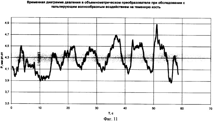 Способ обследования краниальных тканей и устройство для его осуществления (патент 2372837)