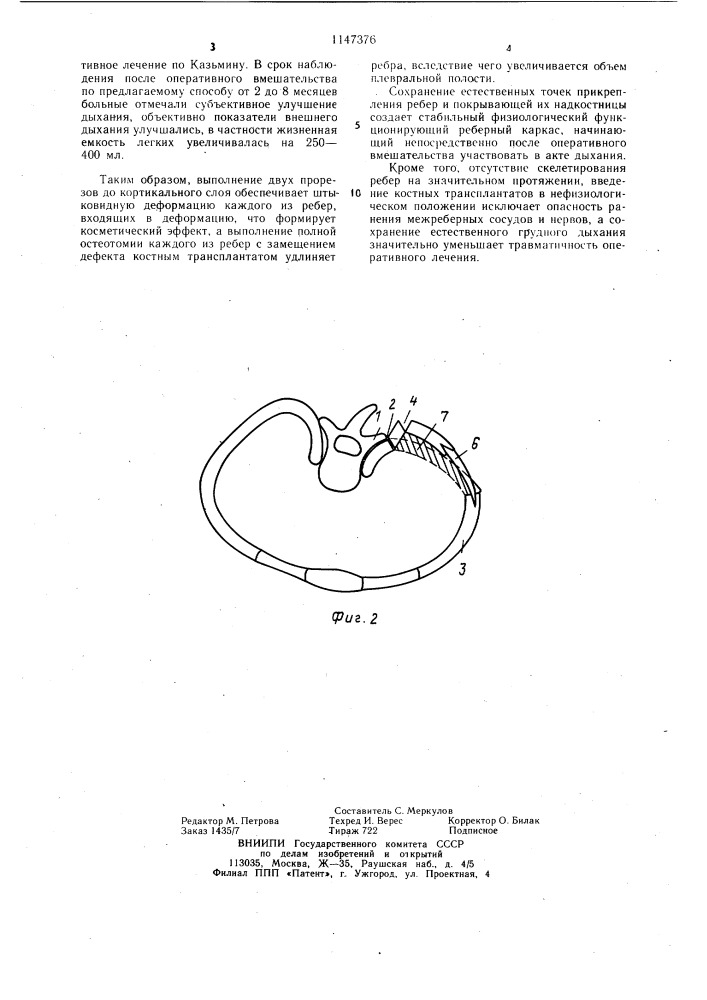 Способ торакопластики (патент 1147376)