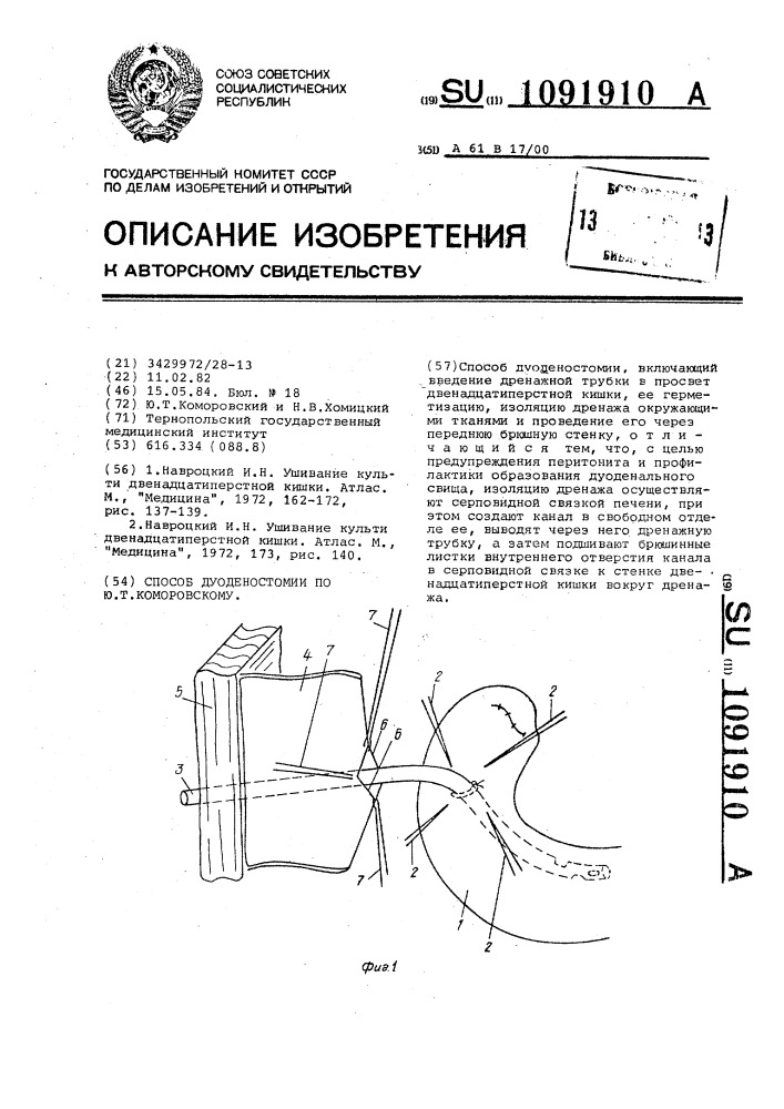 Способ дуоденостомии по ю.т.коморовскому (патент 1091910)